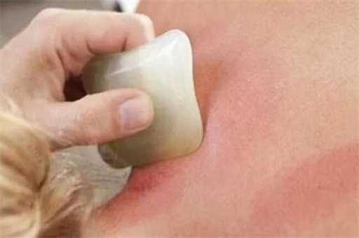 刮痧的作用与功效，刮痧一定要知道的6个禁忌来看看吧 第1张